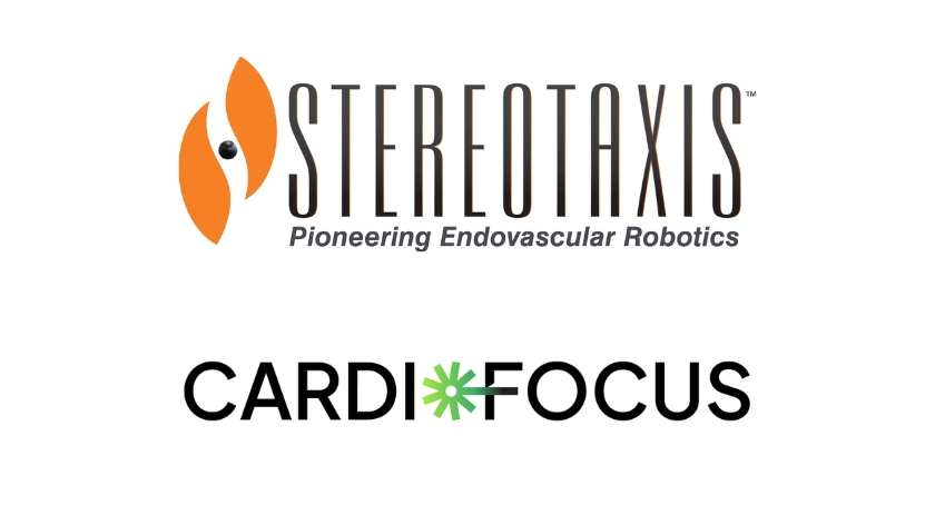 Stereotaxis, CardioFocus Collab to Advance Robotic Pulsed Field Ablation